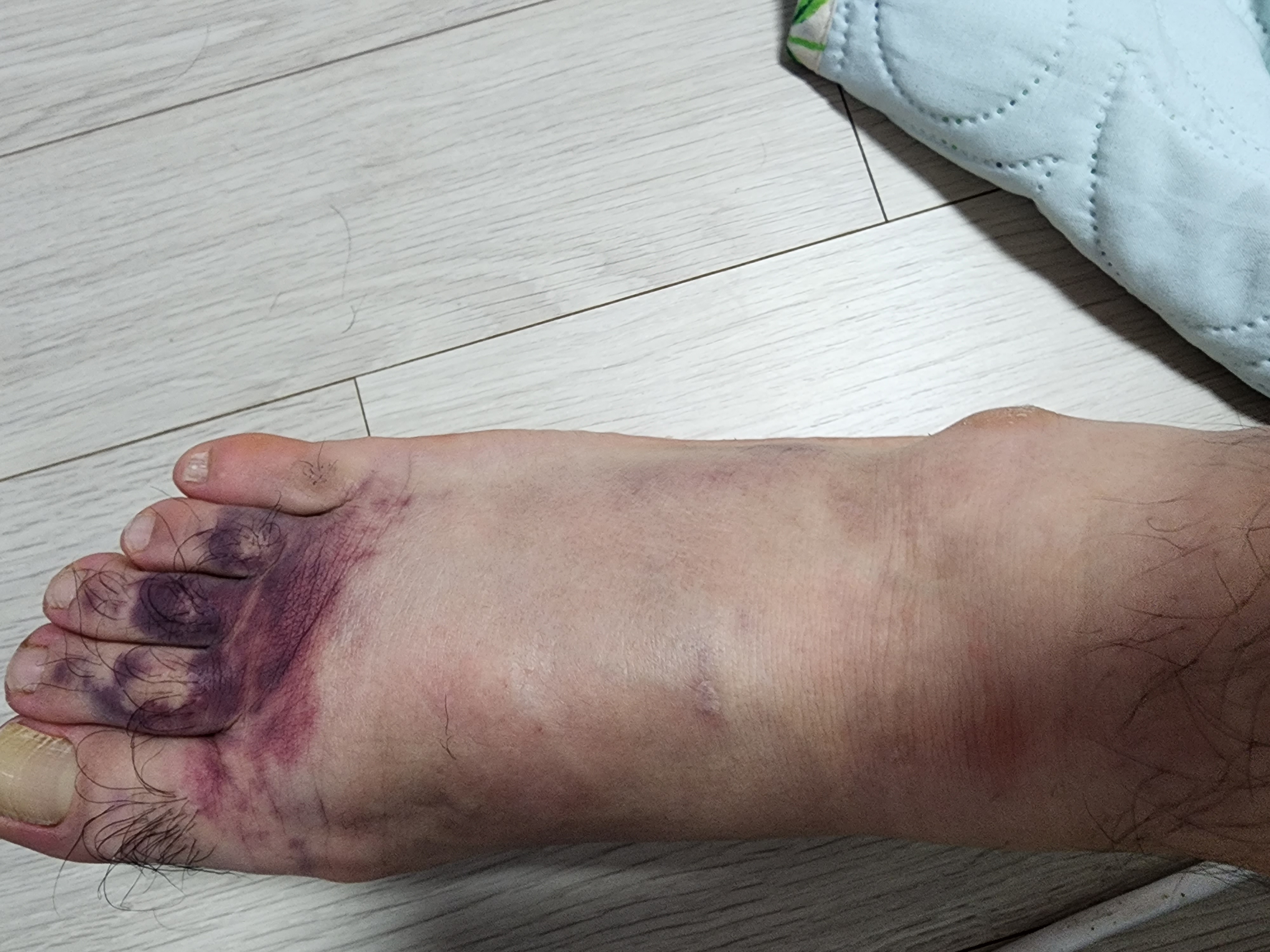 1번 째 사진