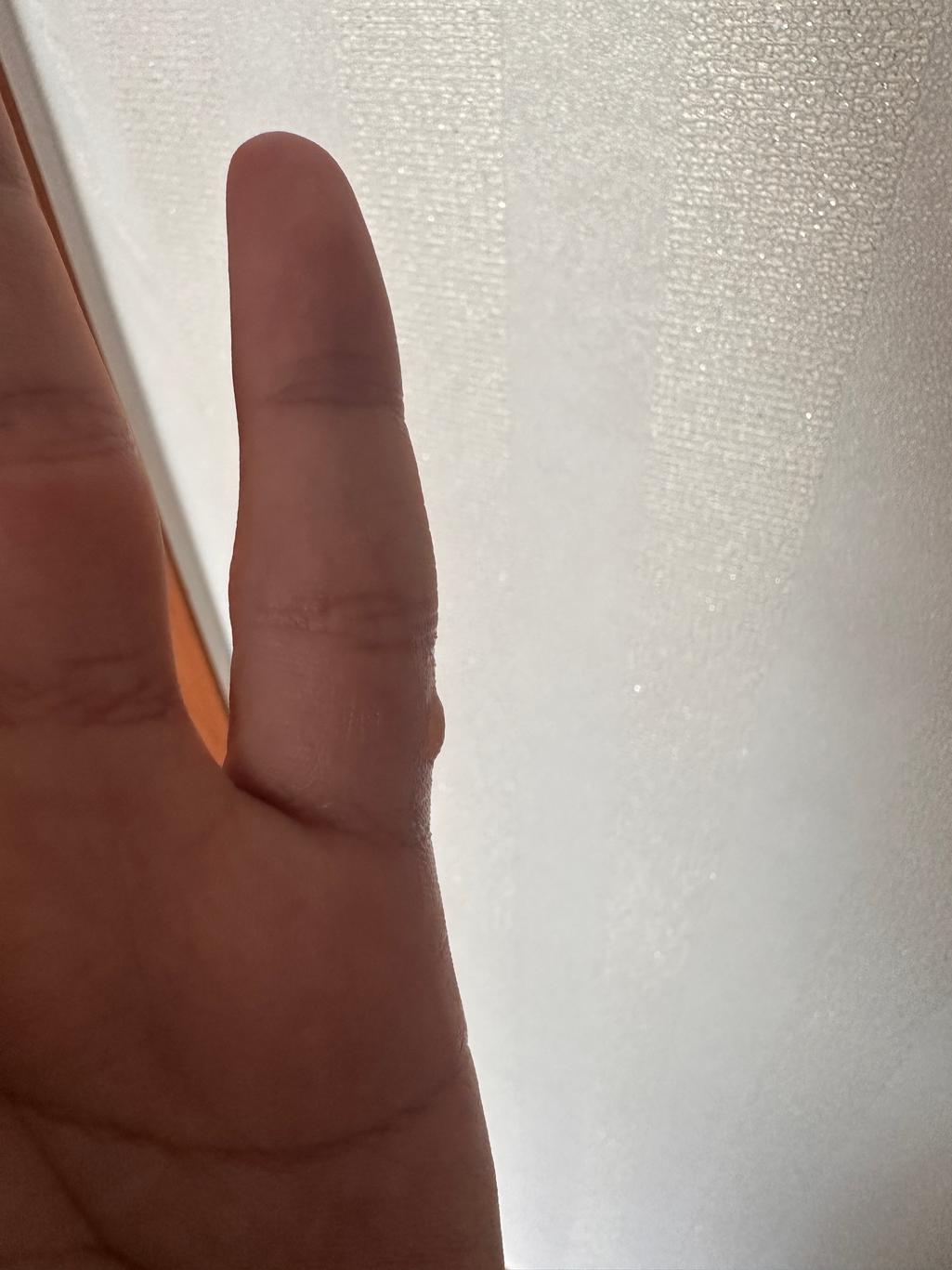 2번 째 사진