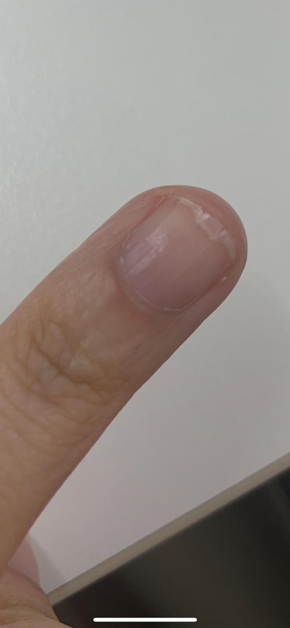 2번 째 사진