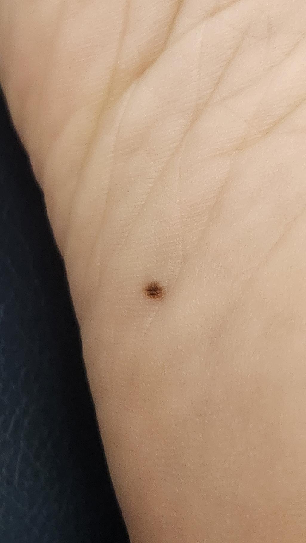 3번 째 사진