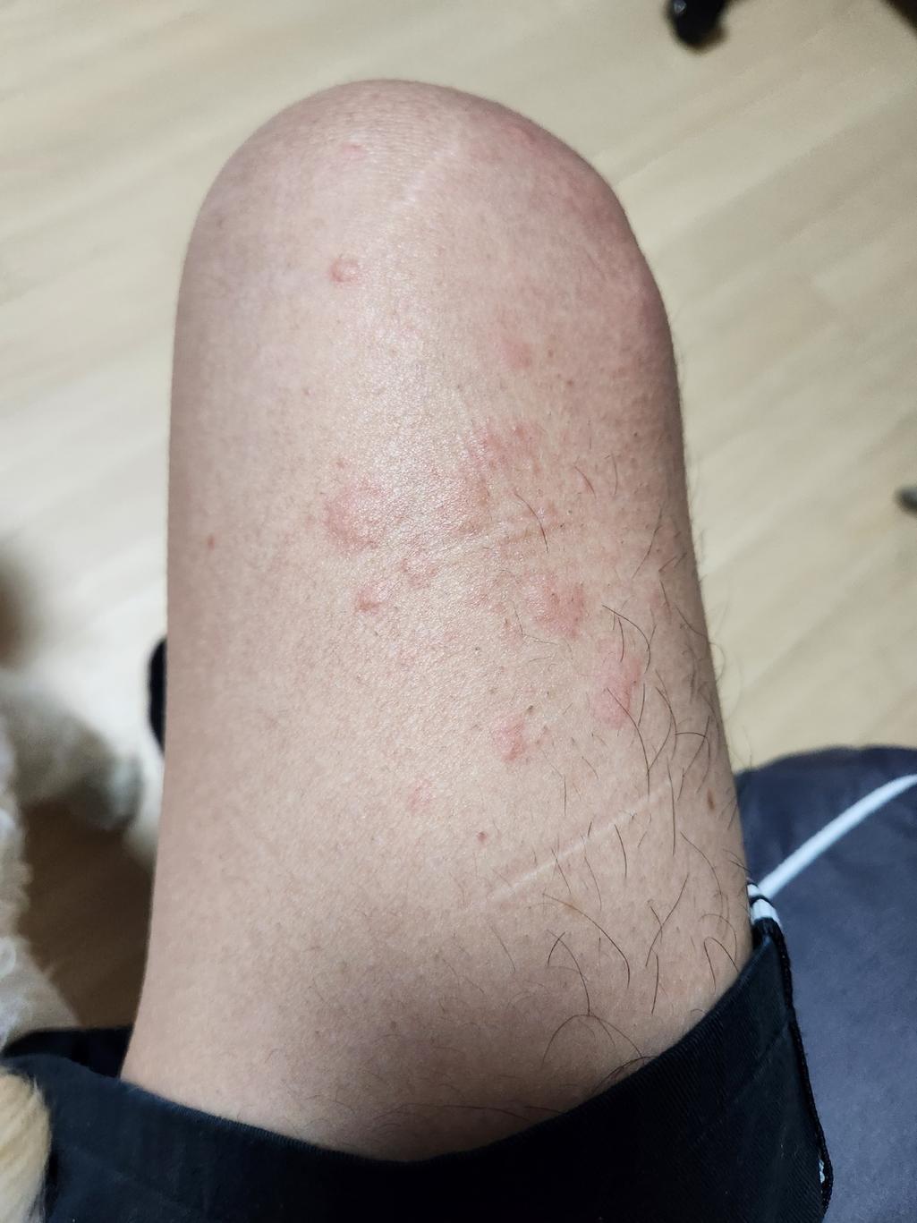 2번 째 사진