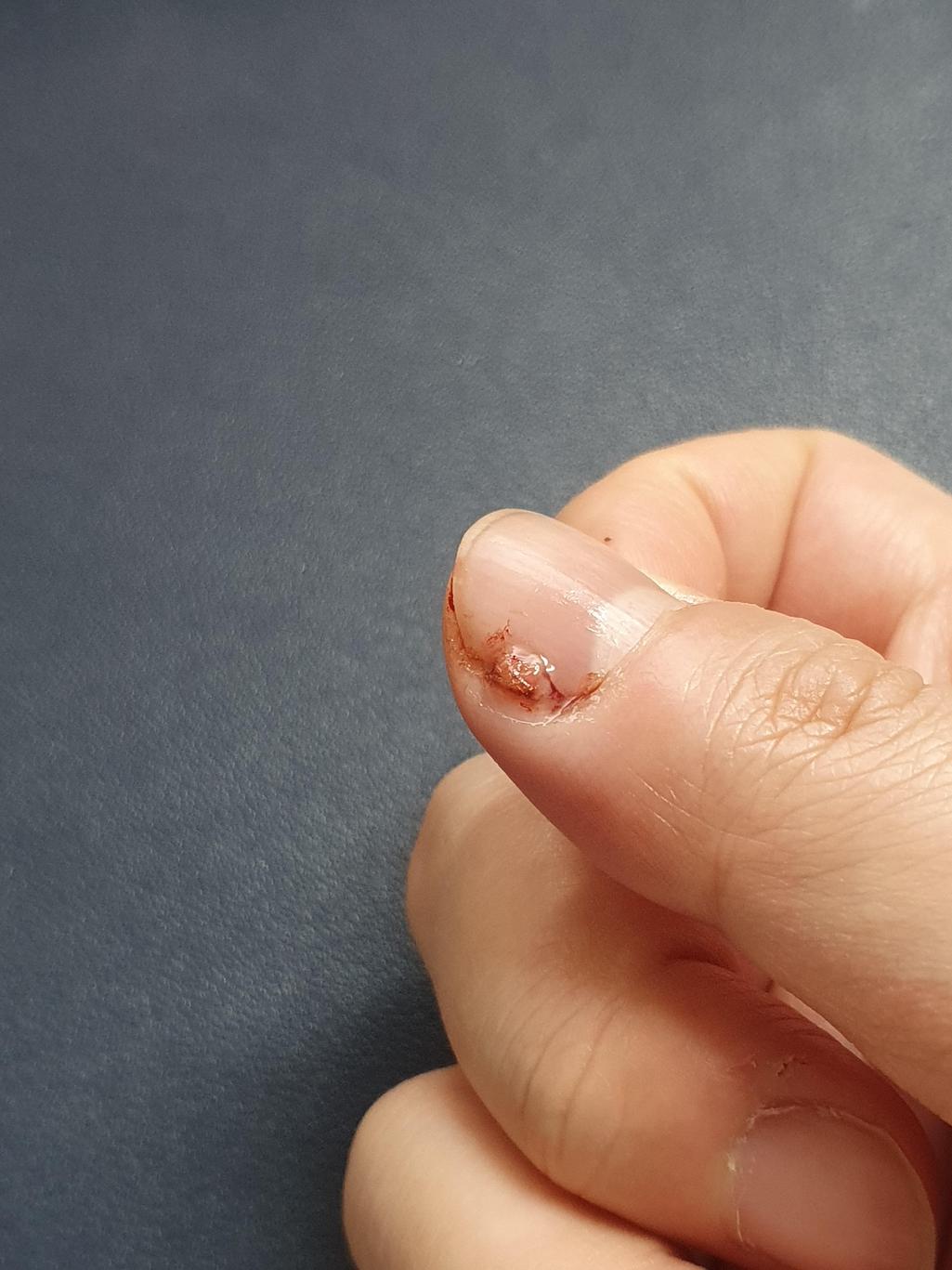 1번 째 사진