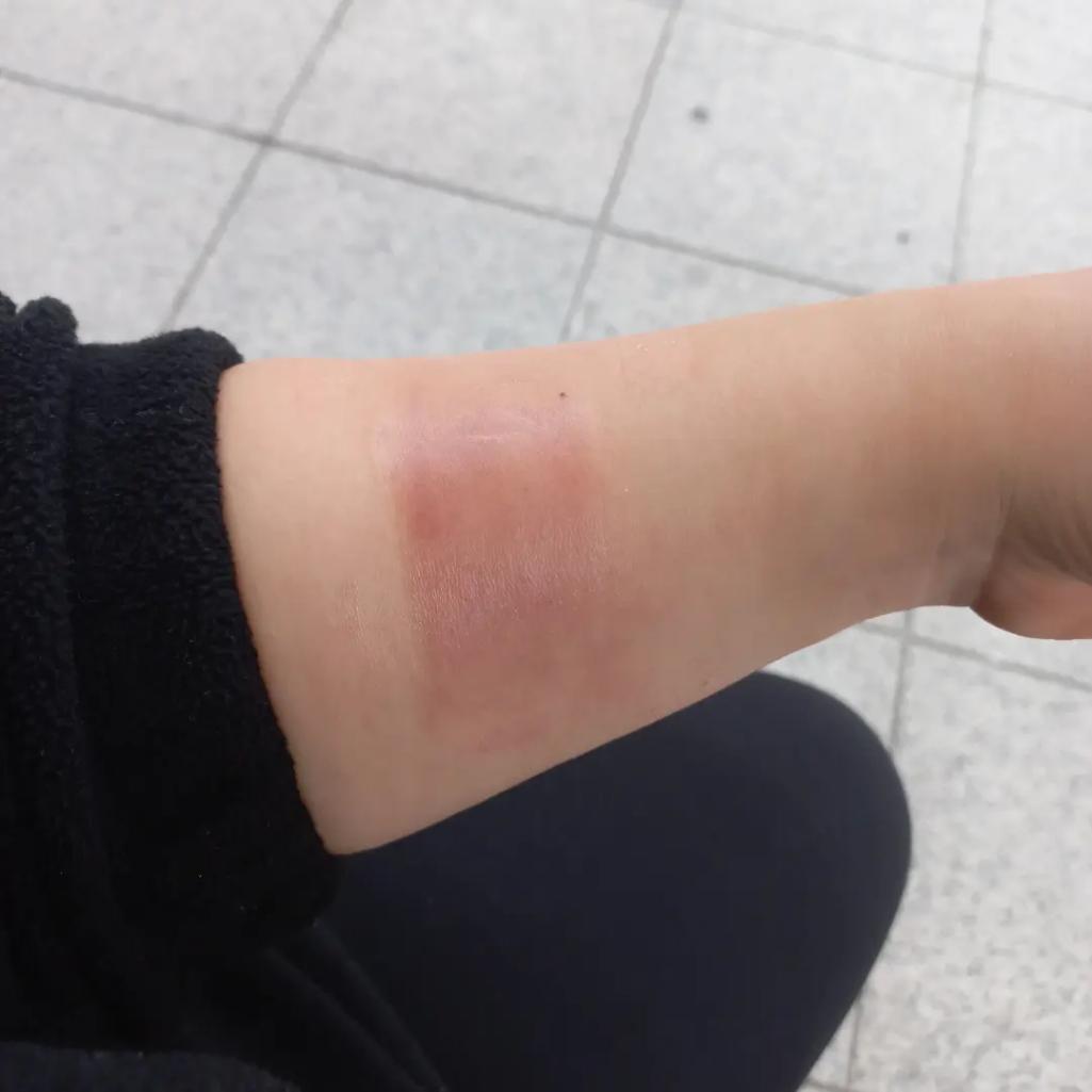 2번 째 사진