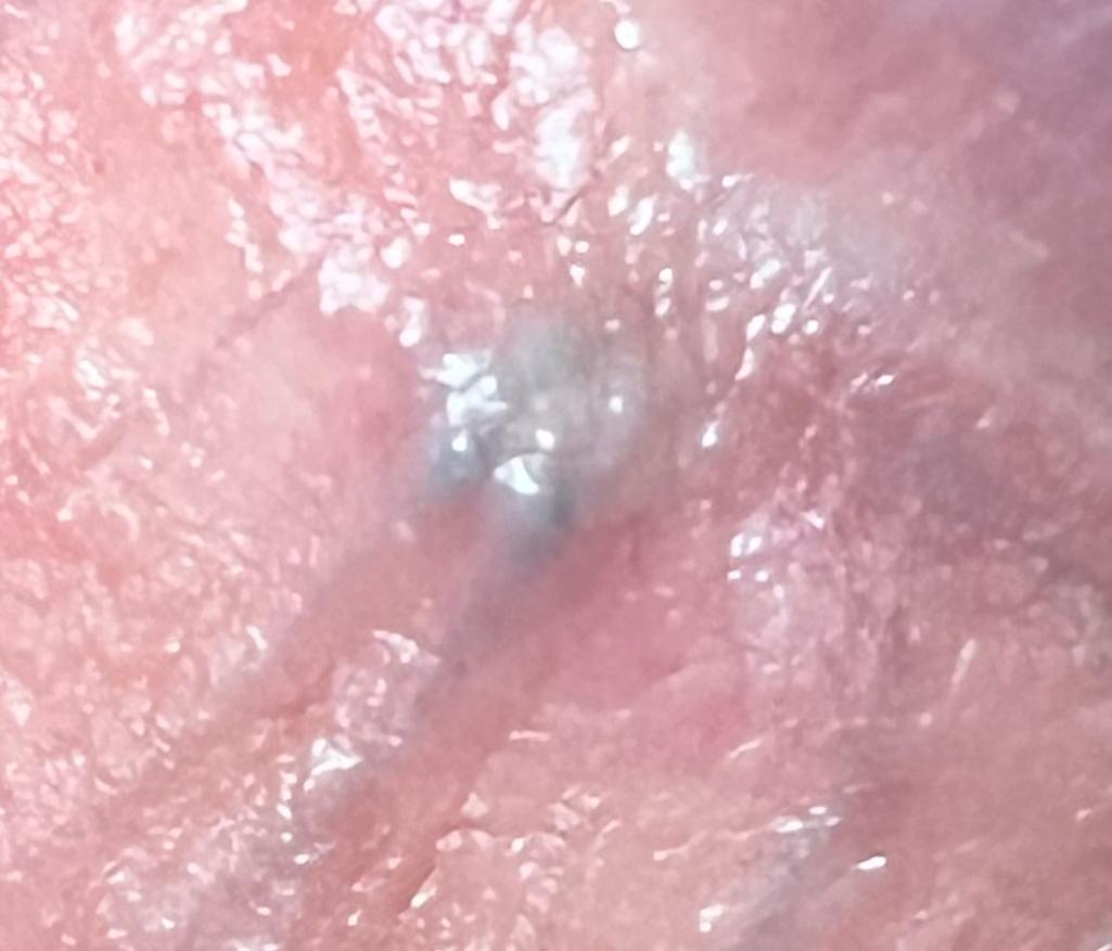 3번 째 사진