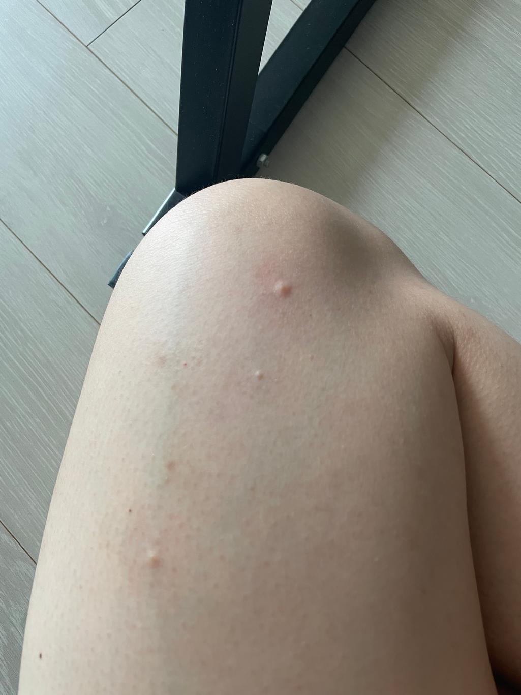 5번 째 사진