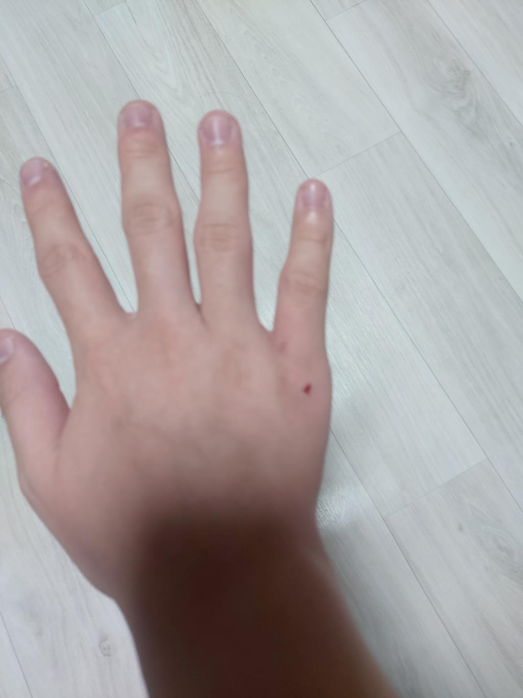 2번 째 사진