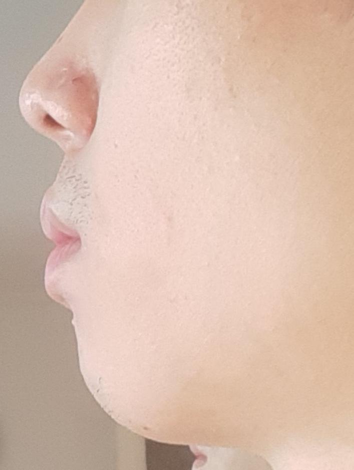 8번 째 사진