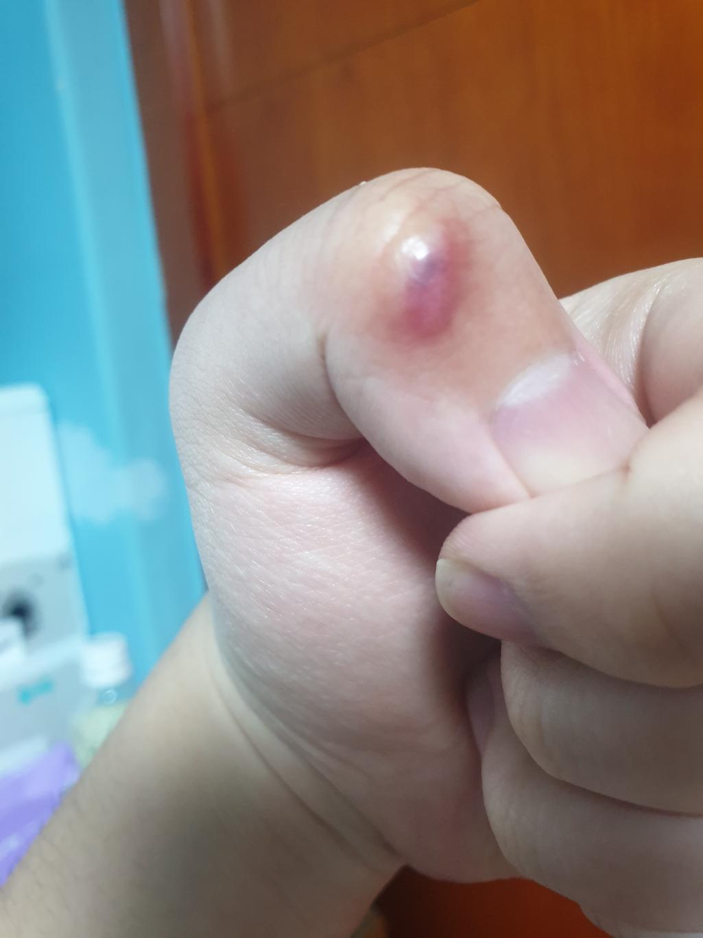 1번 째 사진