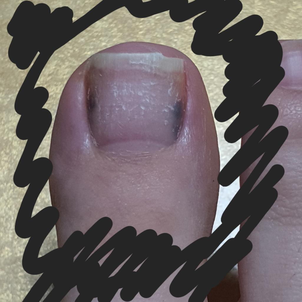 2번 째 사진