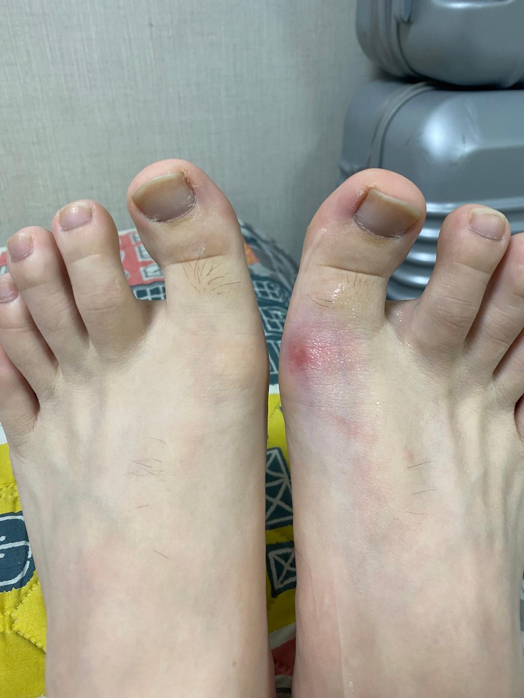 2번 째 사진