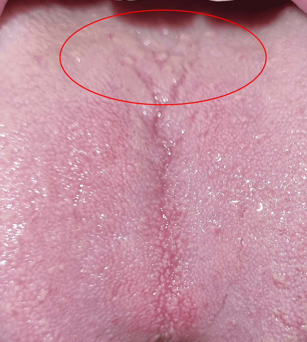 2번 째 사진