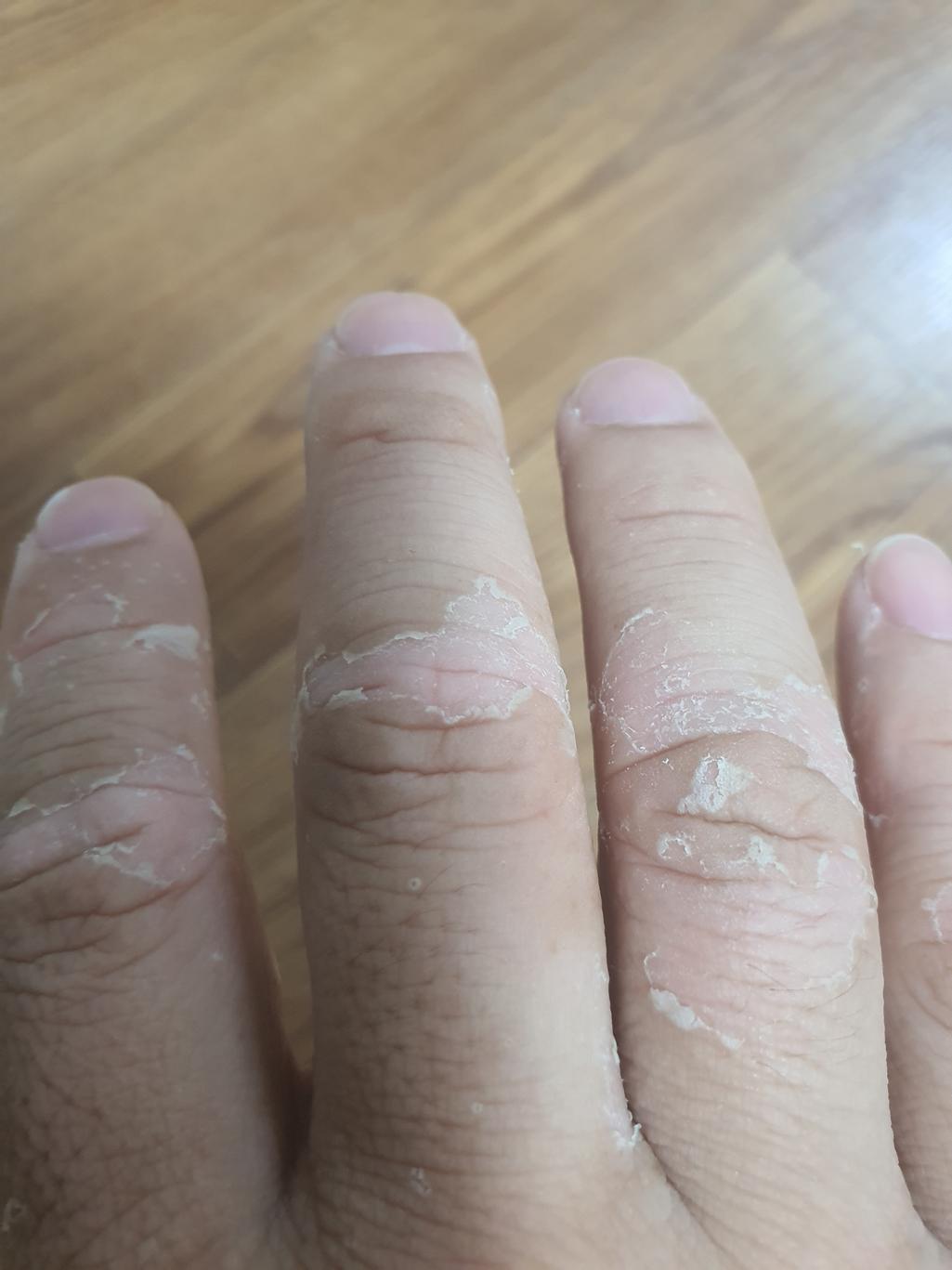 2번 째 사진