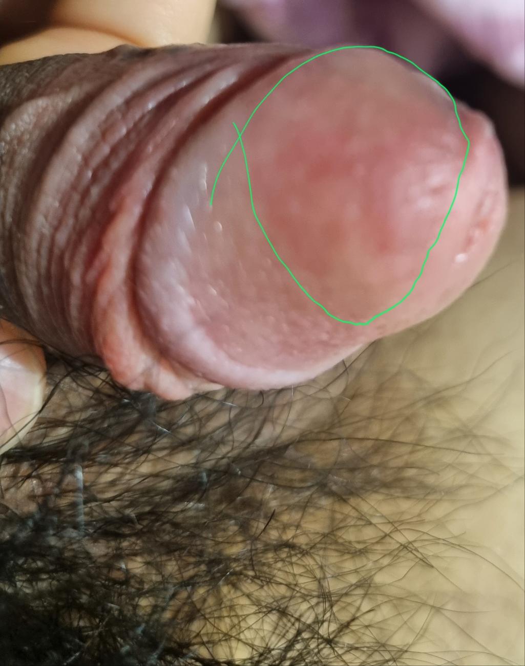 3번 째 사진