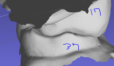 3번 째 사진