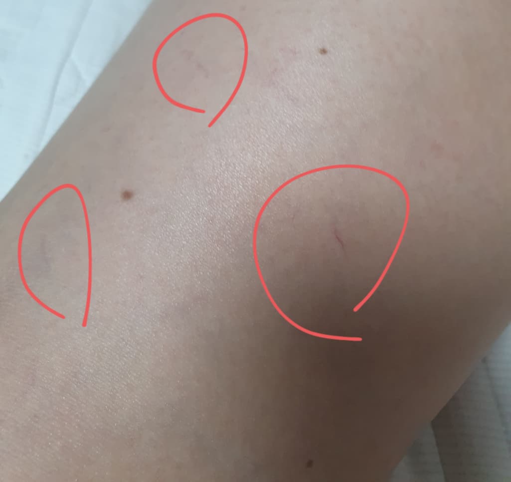 4번 째 사진