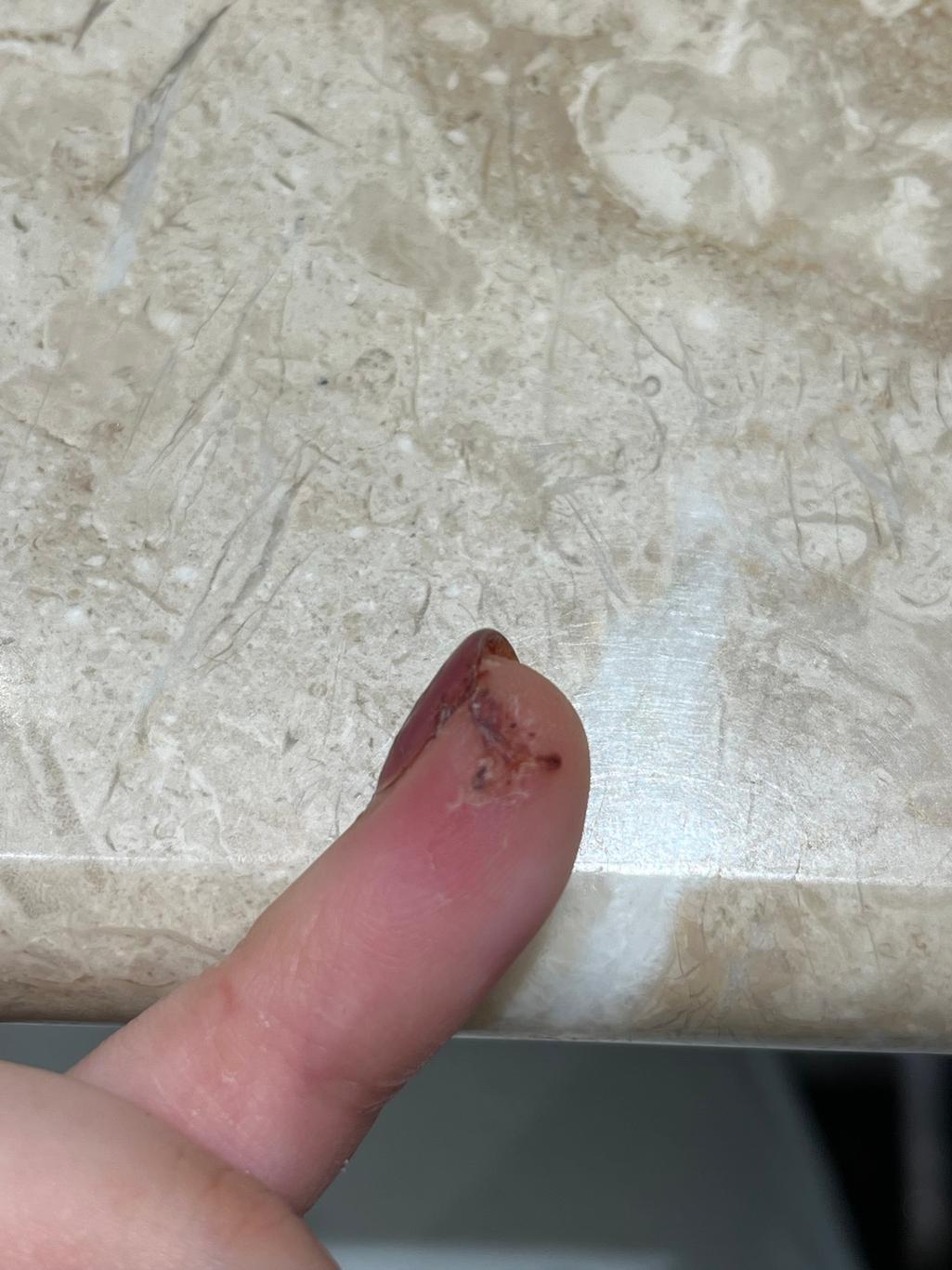 2번 째 사진