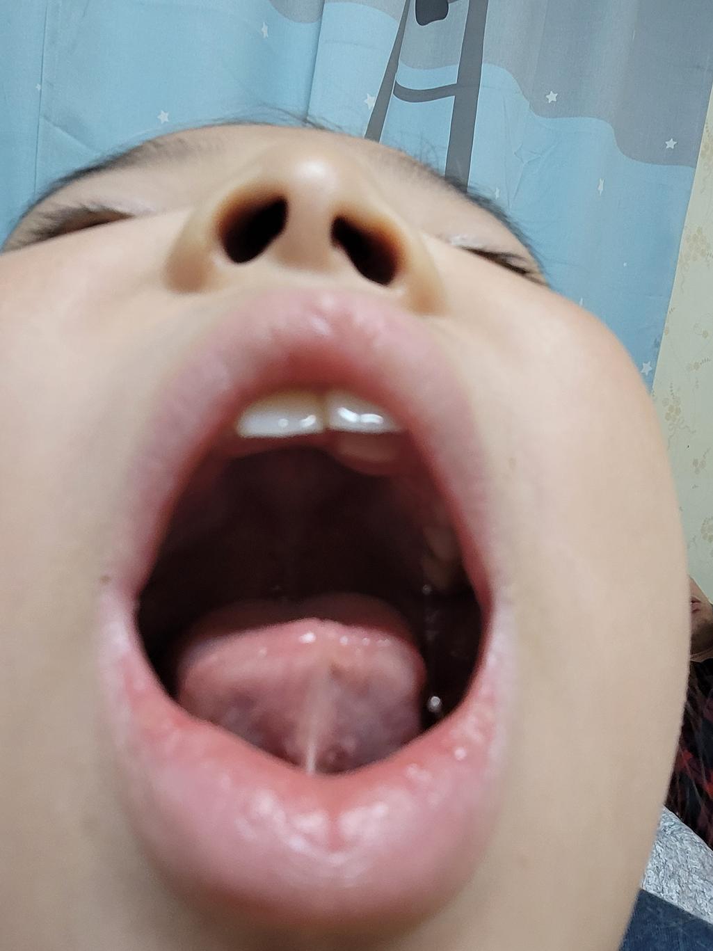 2번 째 사진