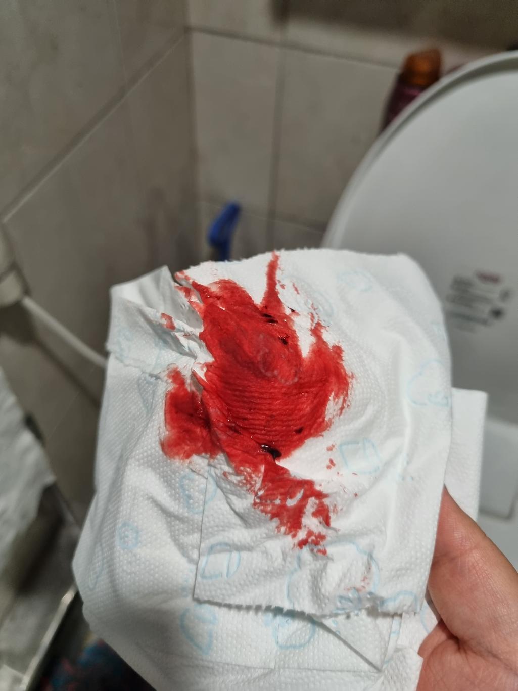 2번 째 사진
