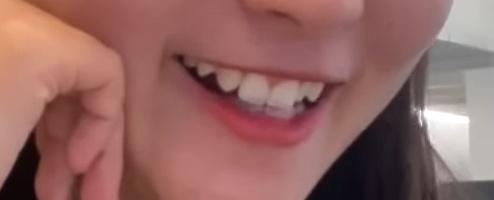 3번 째 사진