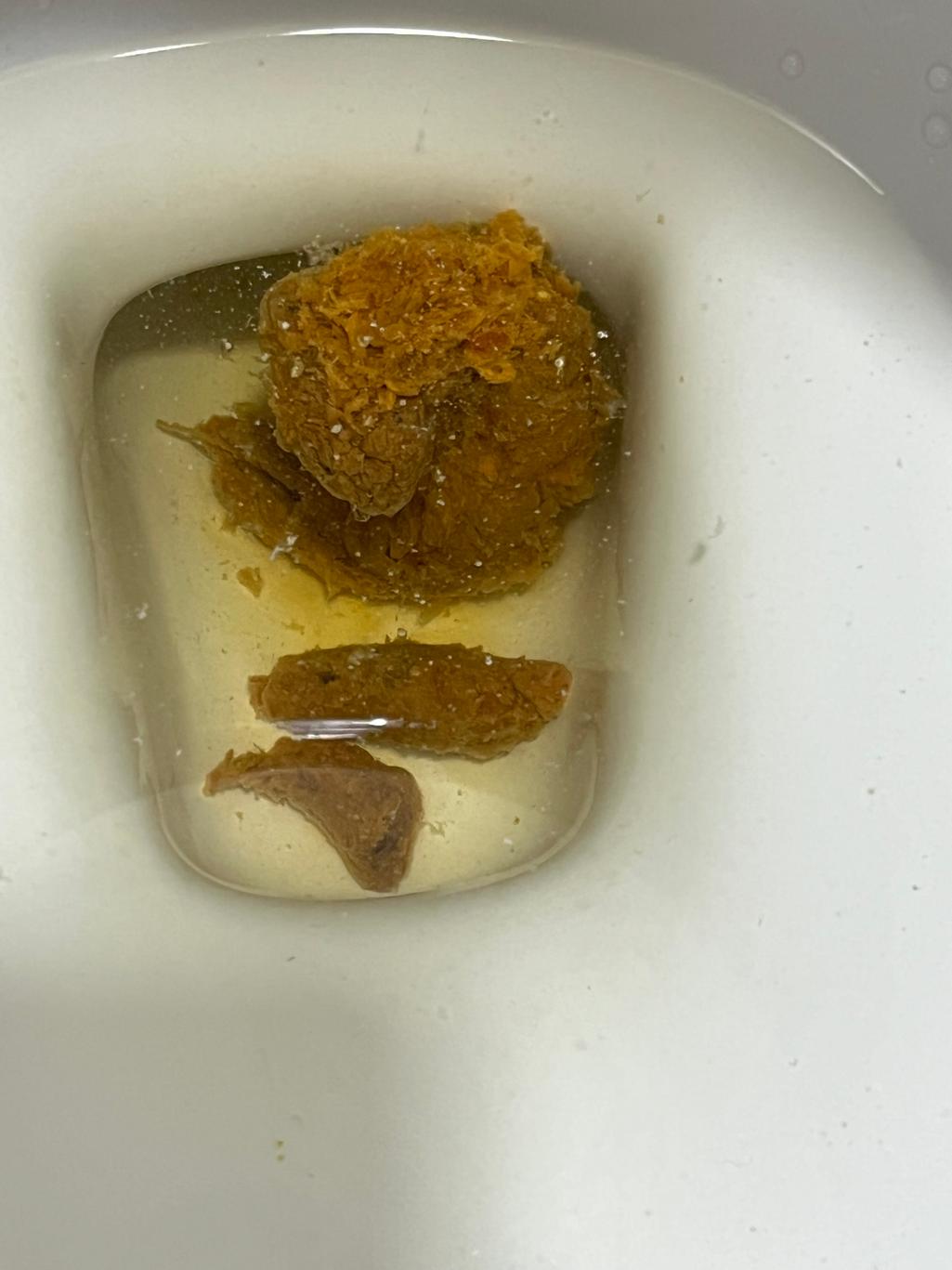 2번 째 사진