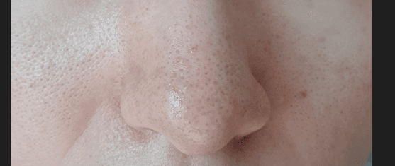 5번 째 사진