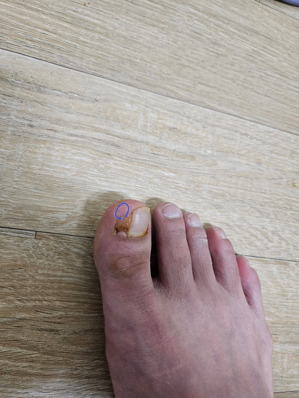 1번 째 사진