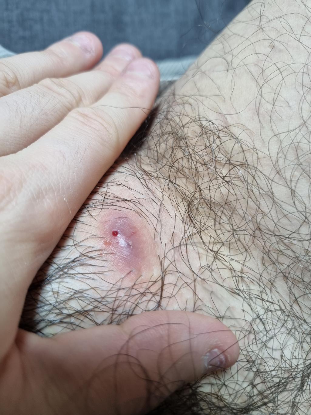 2번 째 사진
