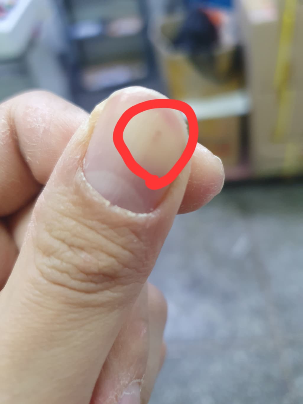 1번 째 사진