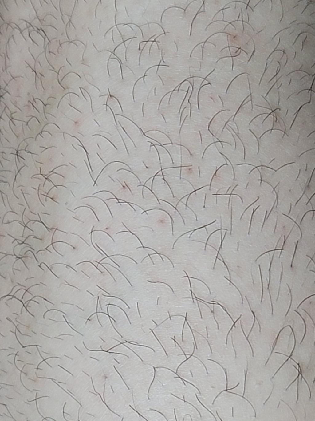 2번 째 사진