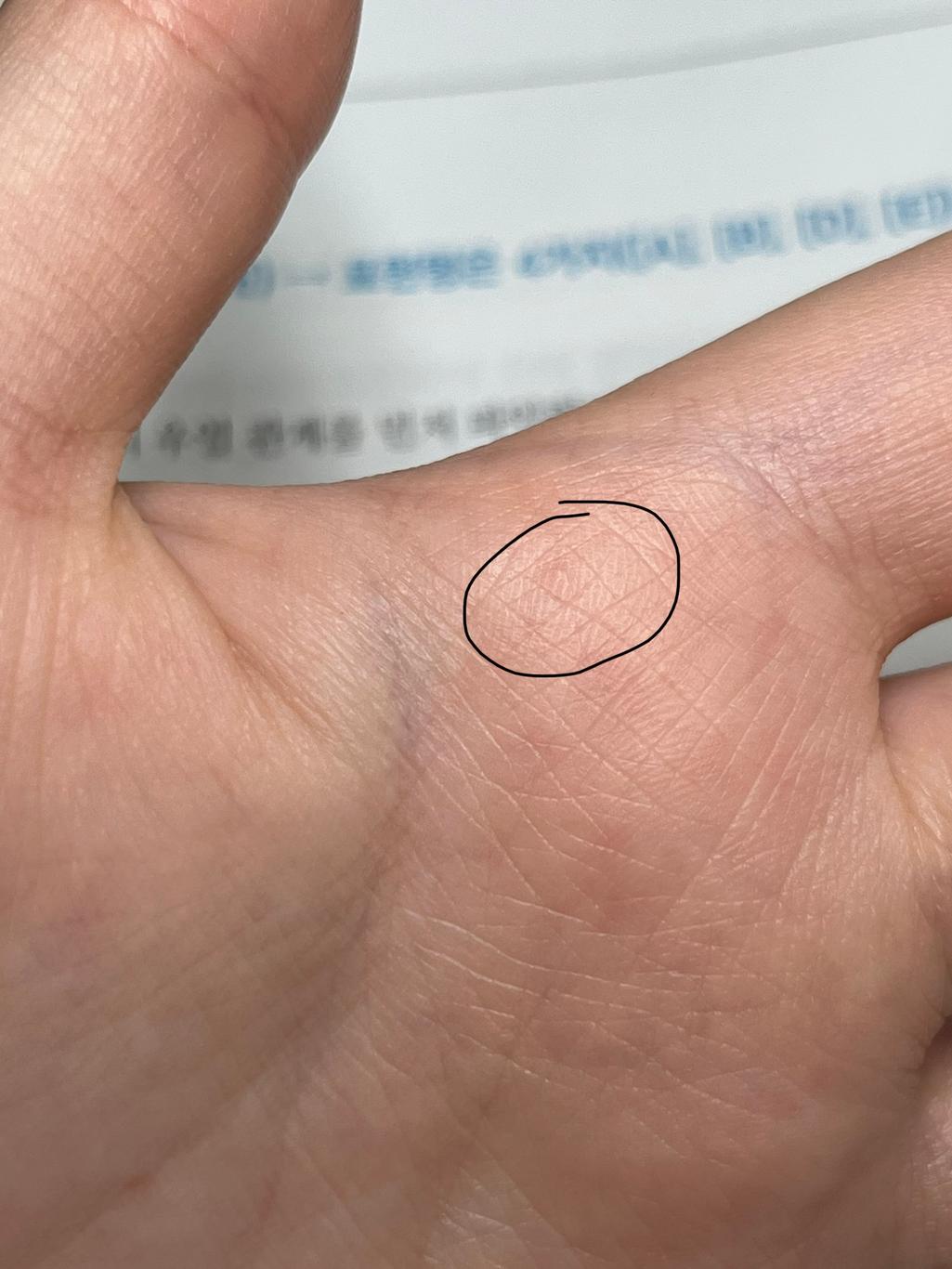 2번 째 사진