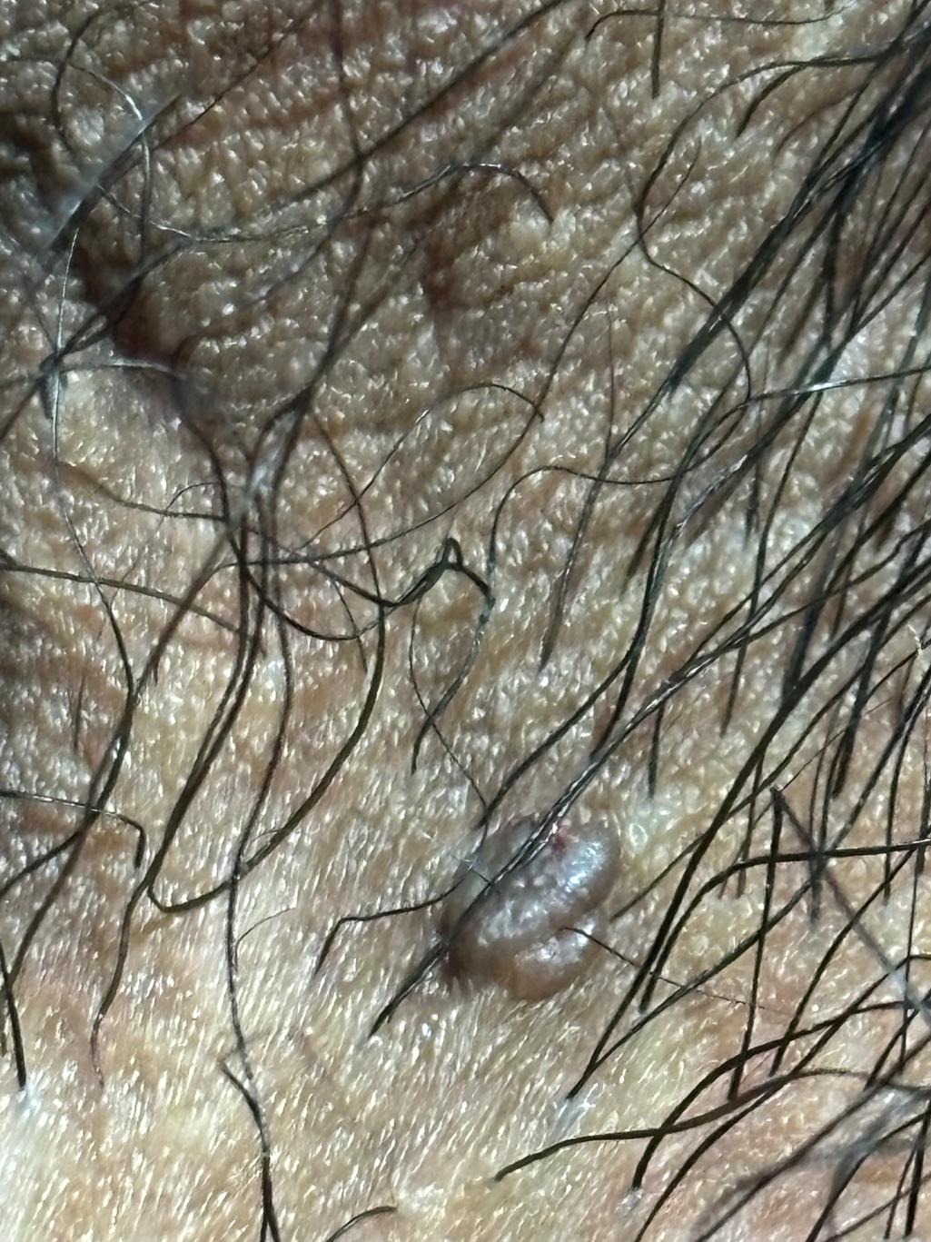 2번 째 사진