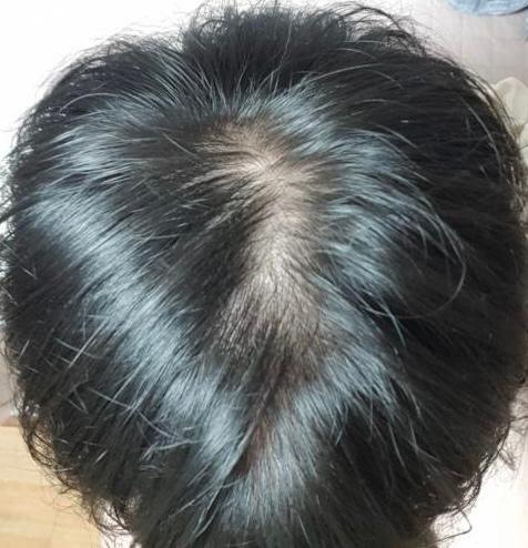 4번 째 사진