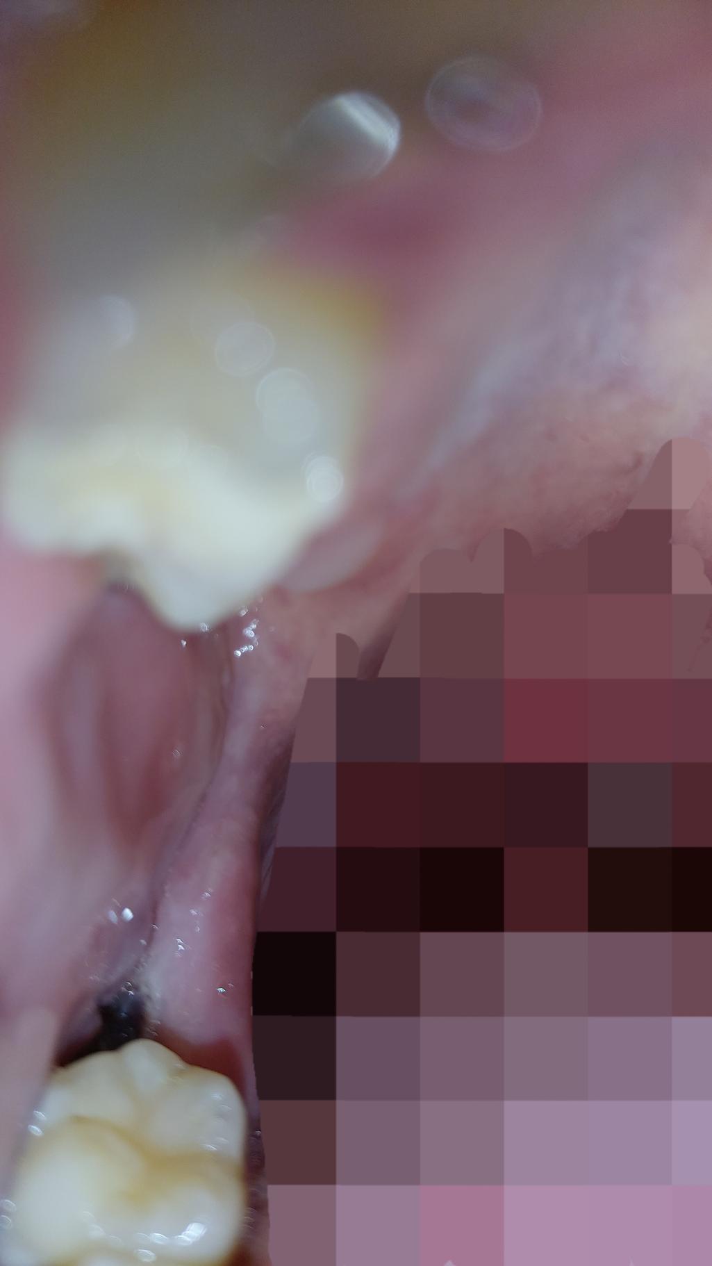 2번 째 사진