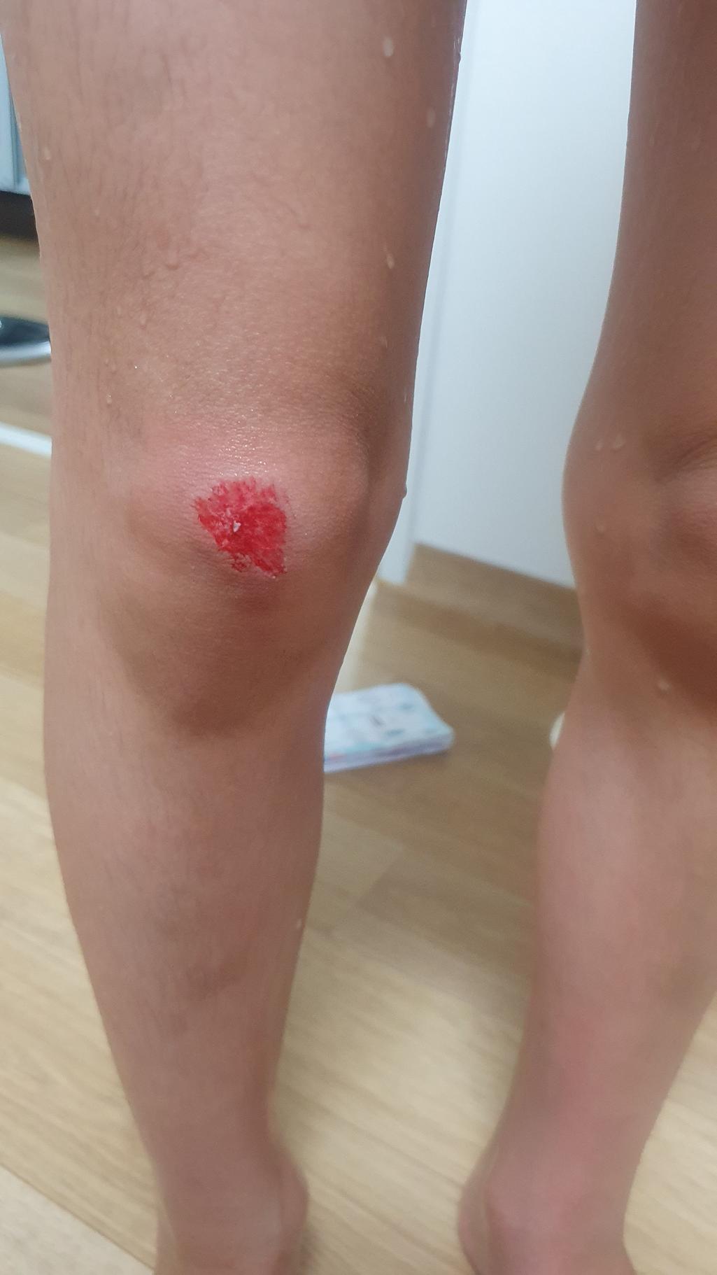 1번 째 사진