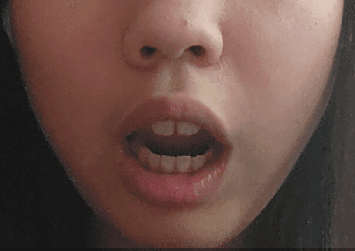 2번 째 사진