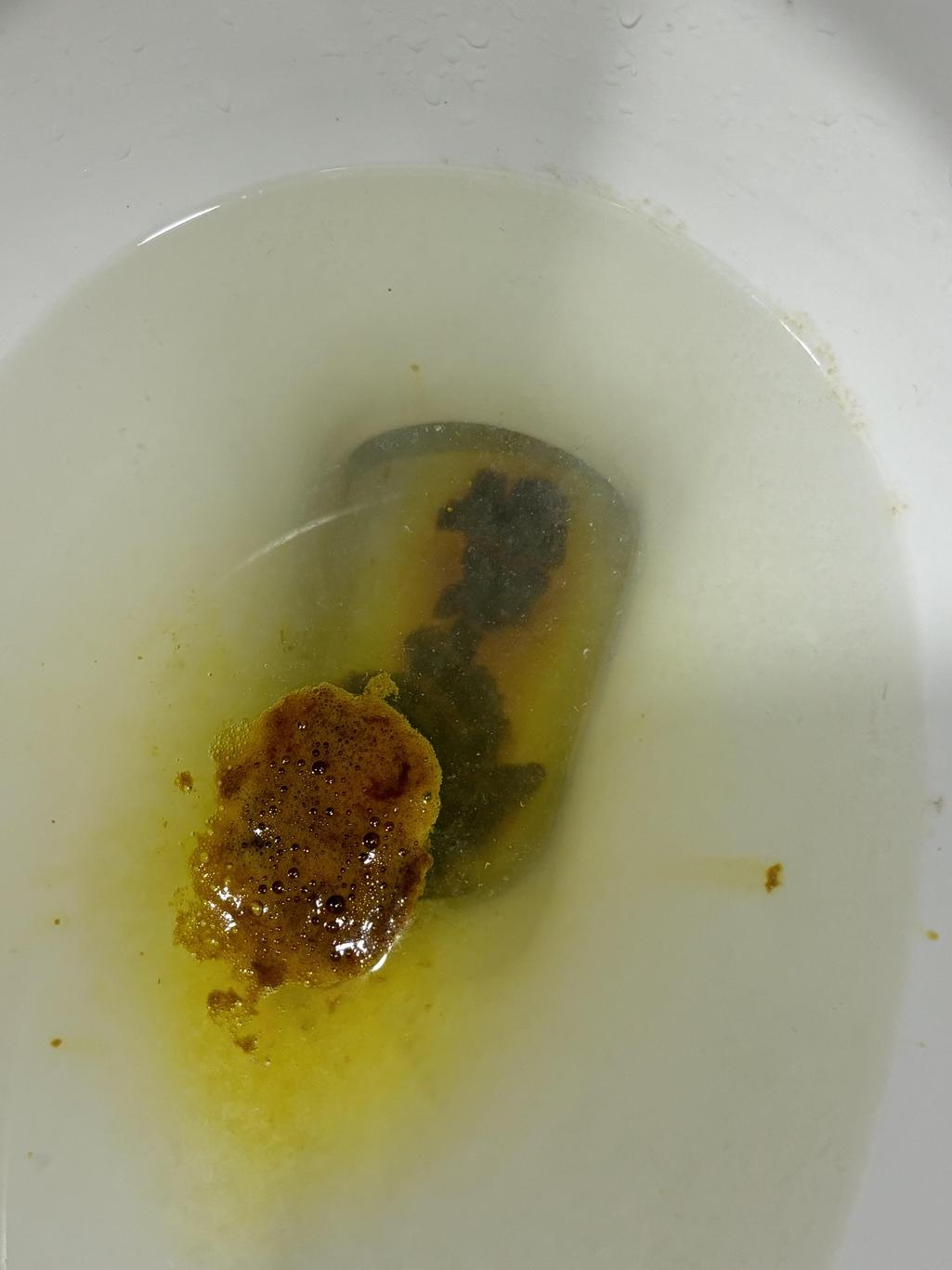 2번 째 사진