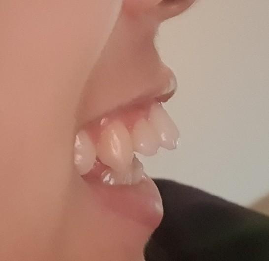 6번 째 사진