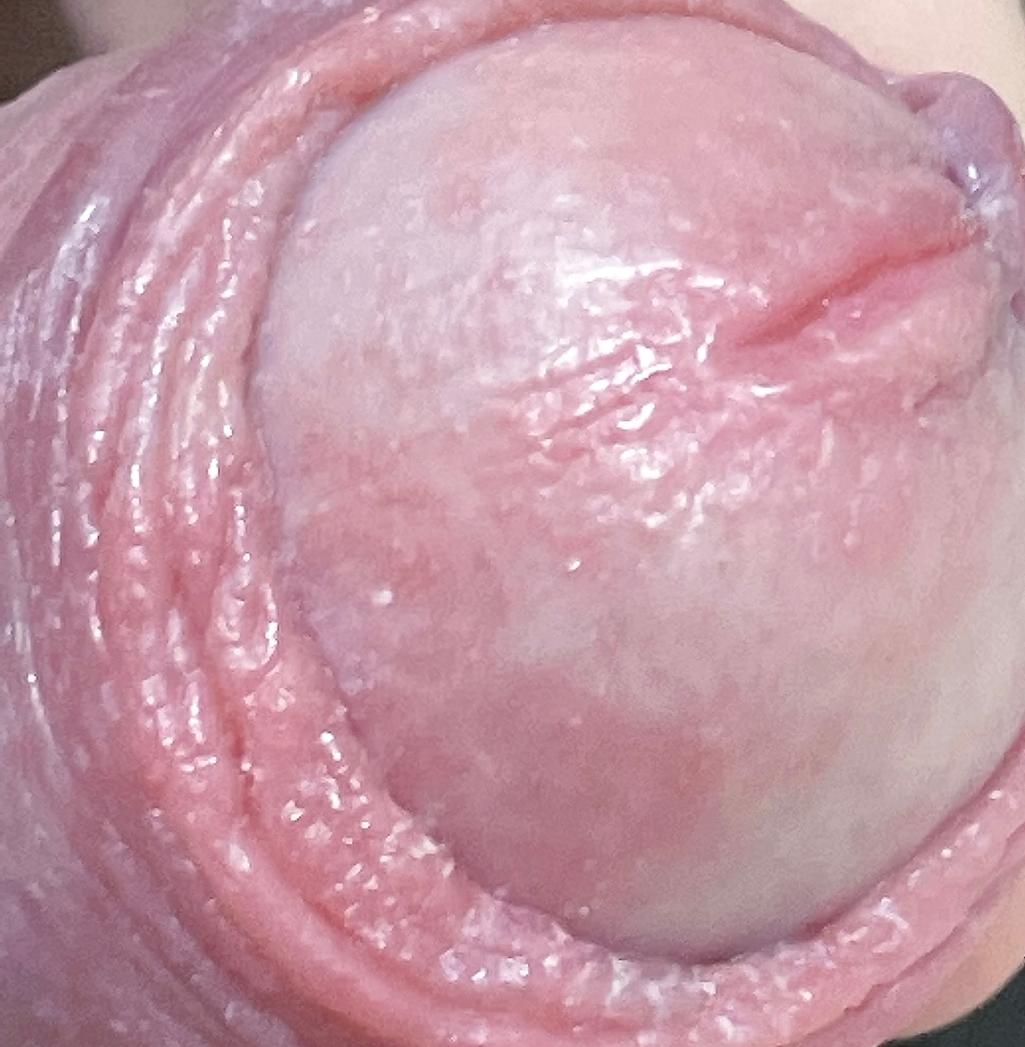 2번 째 사진