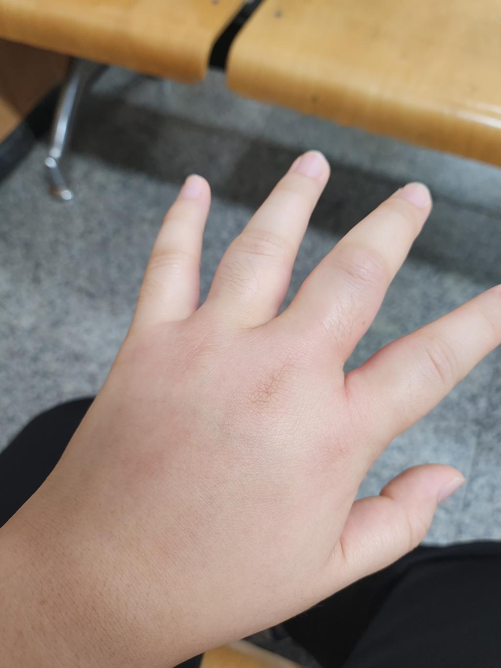 1번 째 사진