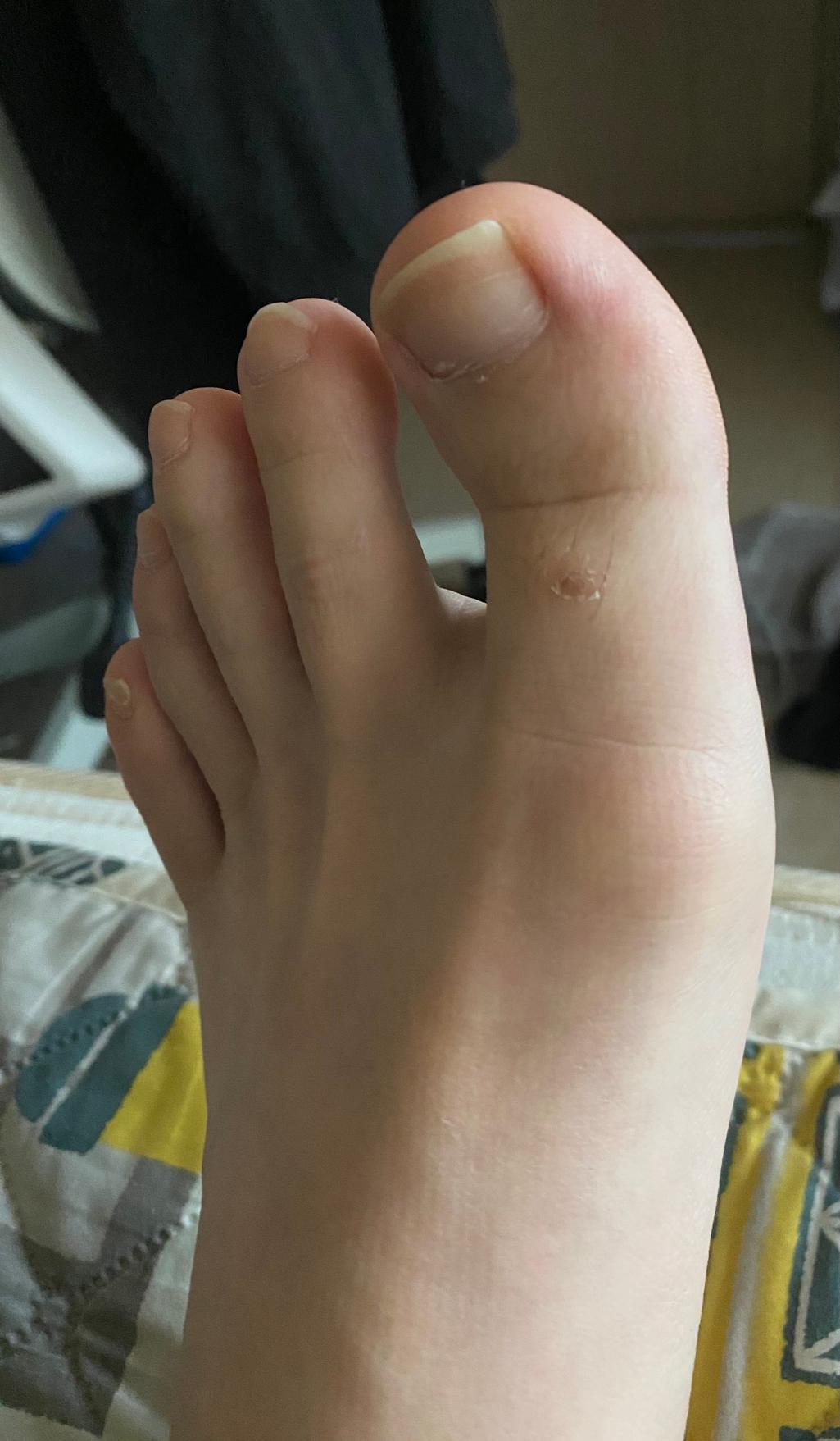 2번 째 사진
