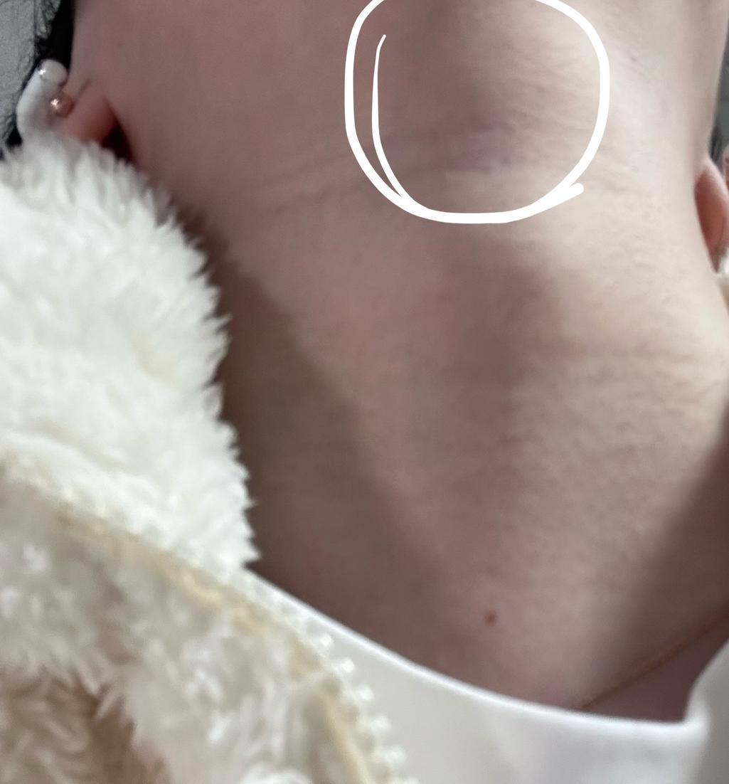 2번 째 사진