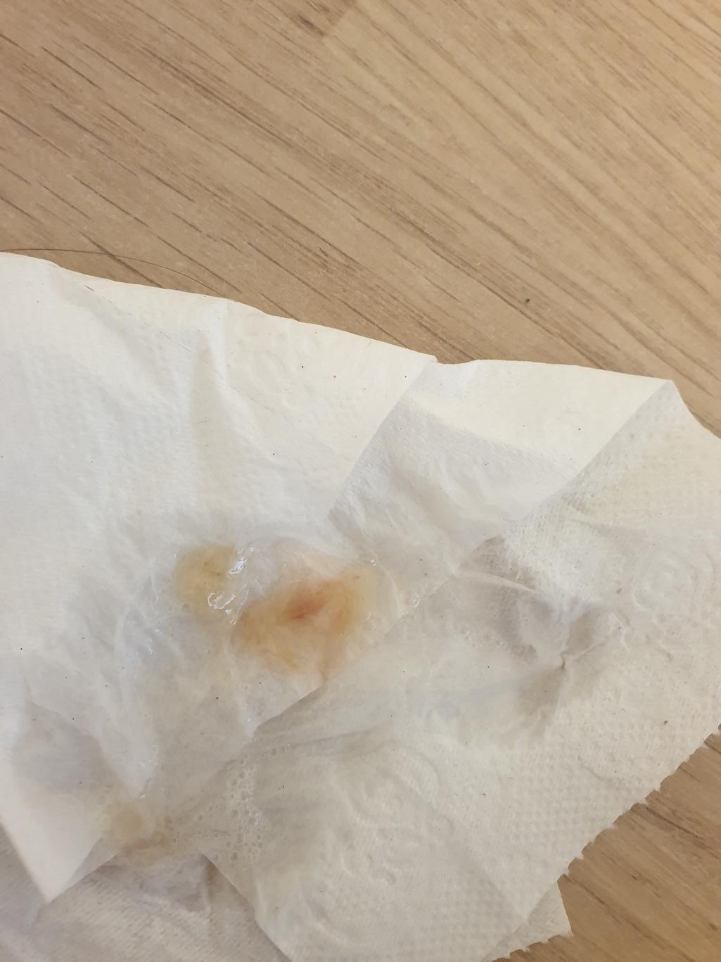 2번 째 사진