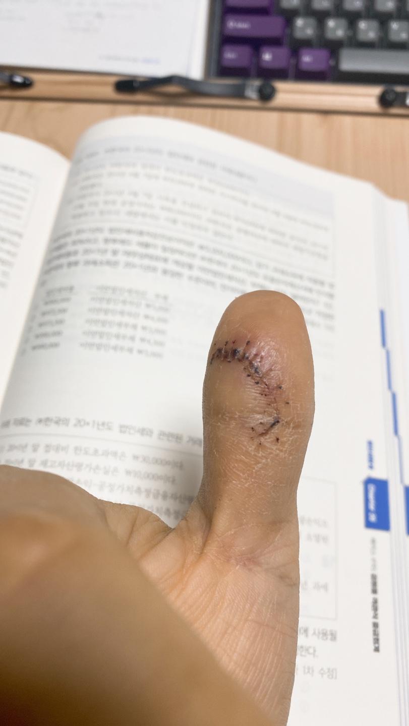 2번 째 사진