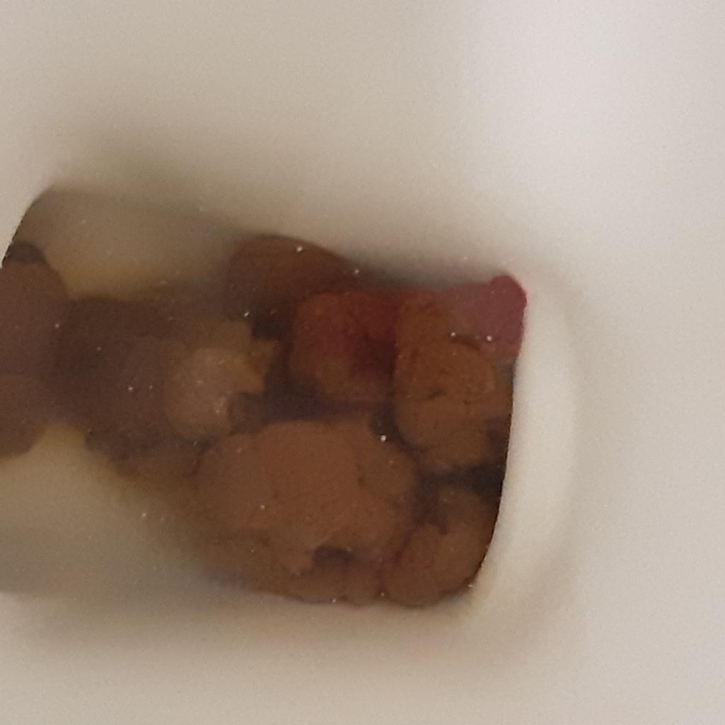 2번 째 사진