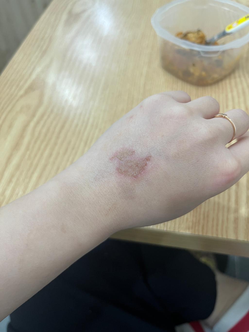 2번 째 사진