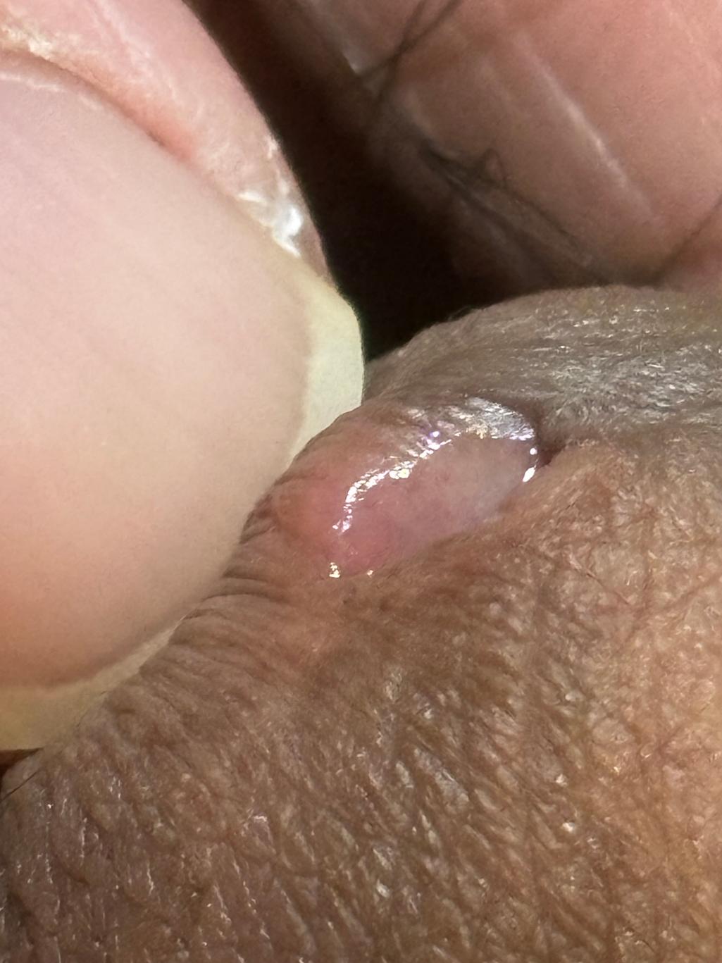 5번 째 사진