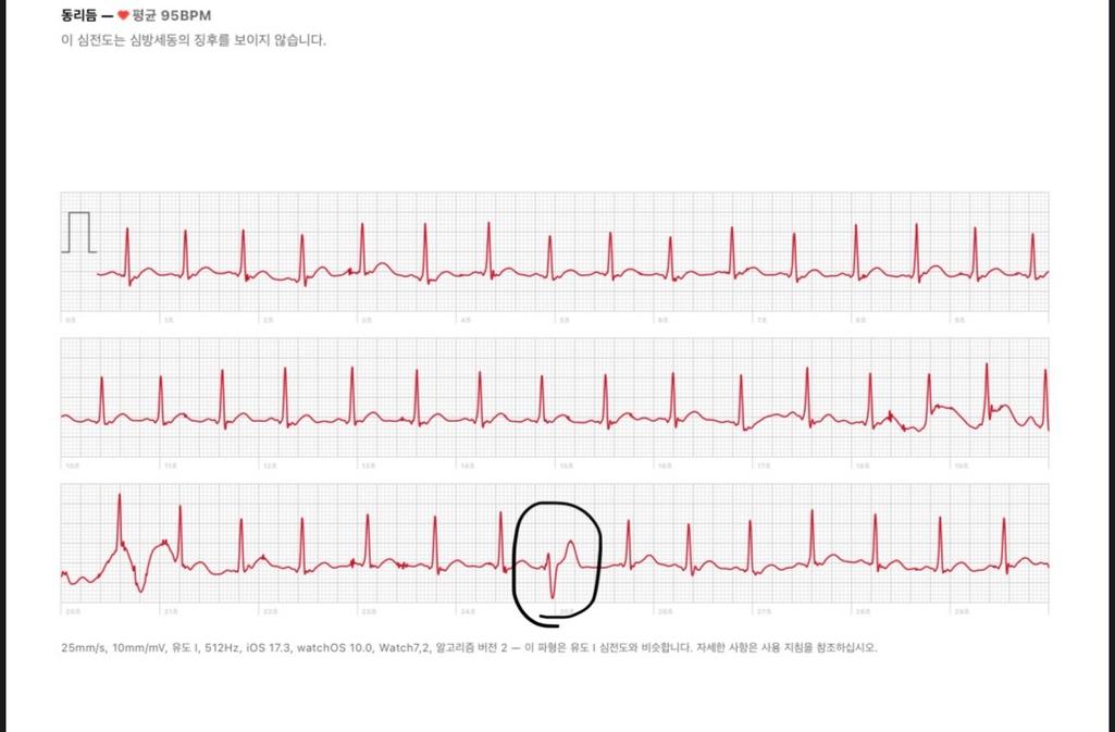3번 째 사진