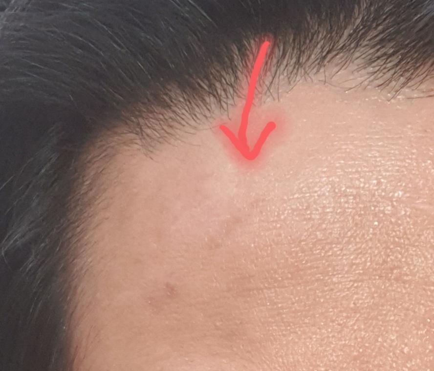 2번 째 사진