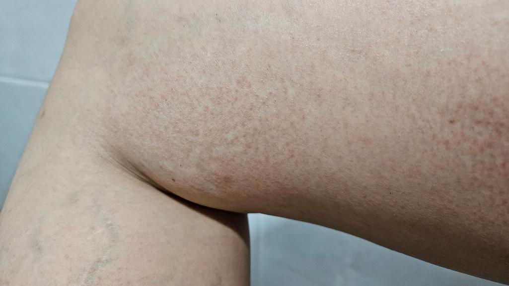 2번 째 사진