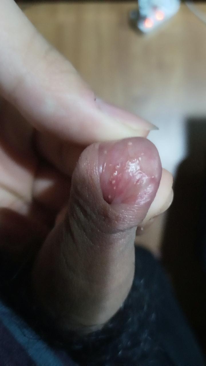2번 째 사진